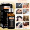 ginger hair growth hair thickening hair loss treatments oil 30ml