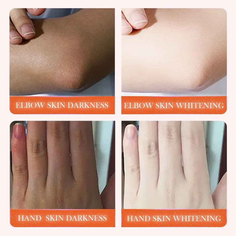 sadoer joint melanin removal serum dark skin lightening & whitening essence2 sadoer joint melanin removal serum dark skin lightening & whitening essence2